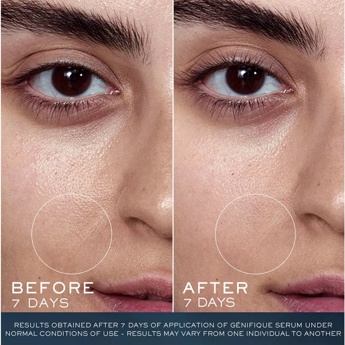 LANCOME Advanced Génifique Holiday Skincare Set - Medaid International