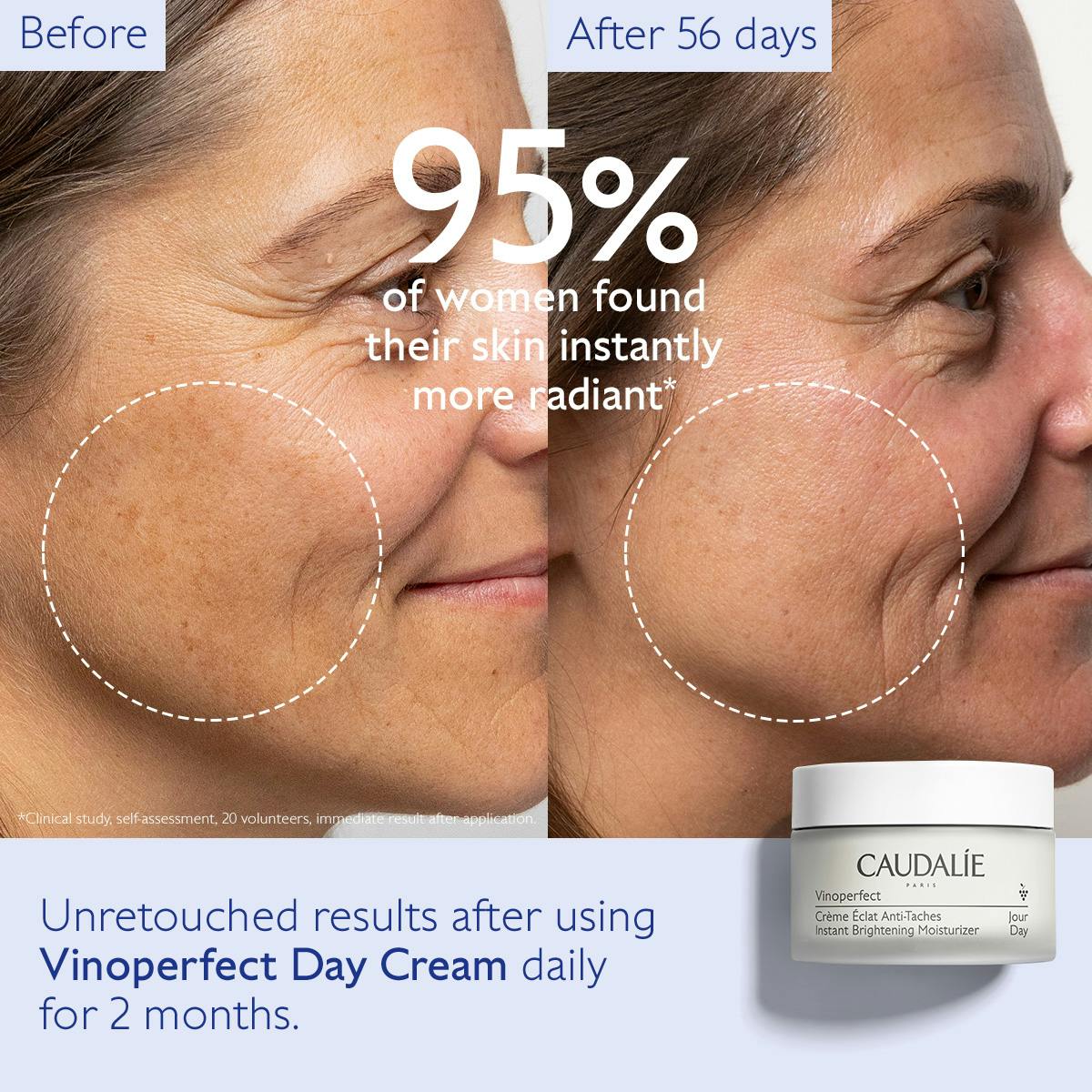 Instant Brightening Moisturiser with Niacinamide - Medaid