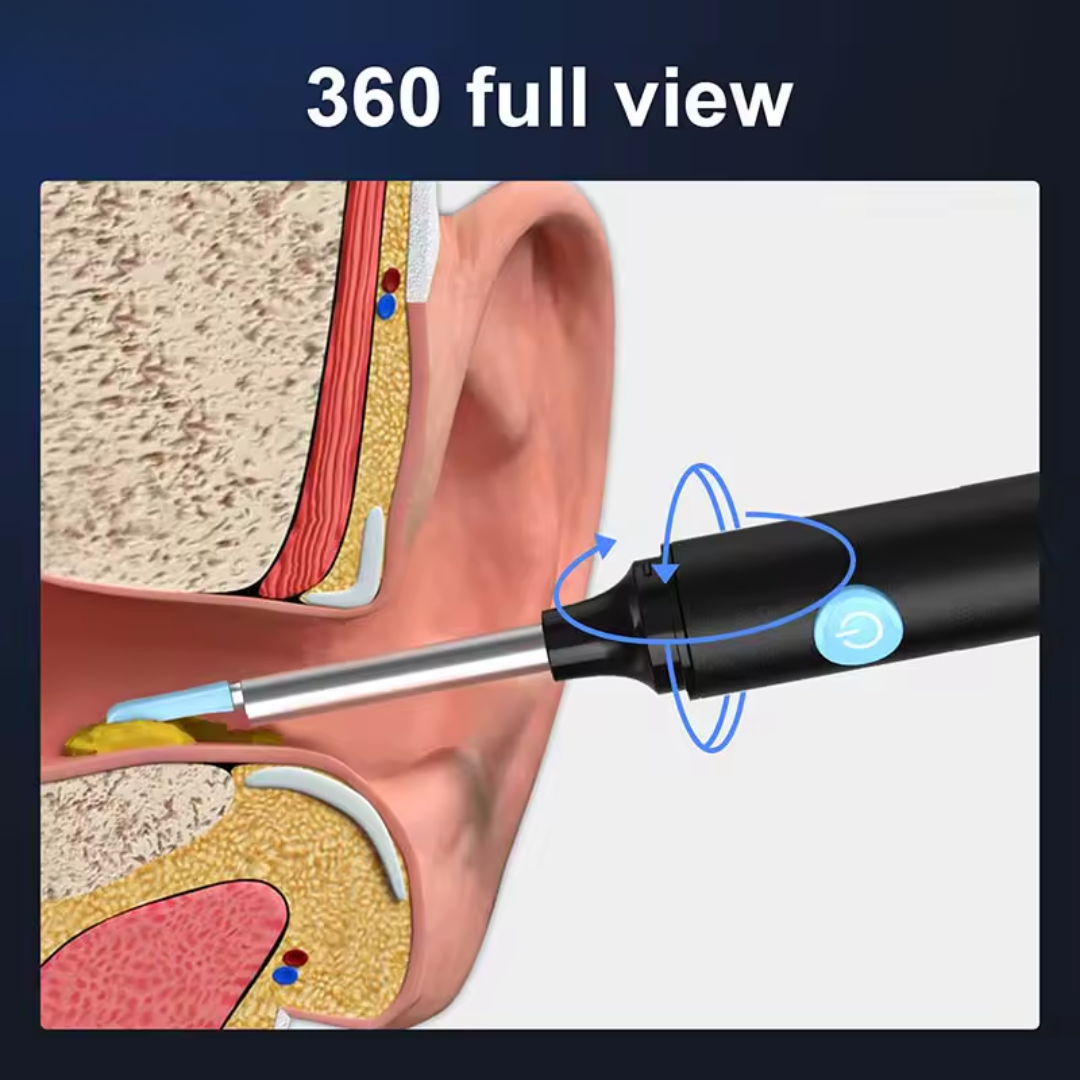 Ear Wax Removal Tool with Camera – HD Ear Cleaner with 6 LED Lights – Black - Medaid International