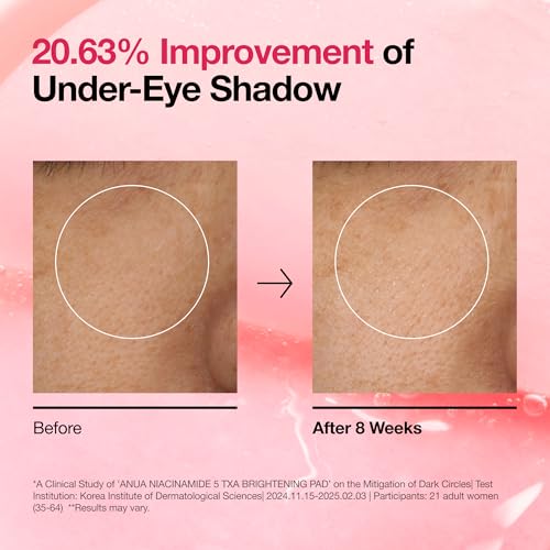 Anua Niacinamide 5 TXA Toner Pads – Hydrating Facial Pad for Even-Looking Skin Tone & Daily Radiance Care, Glow up Under-Eye with Tranexamic Acid, Korean Skin Care (210ml, 60 Pads)|B0DQKLVC7L