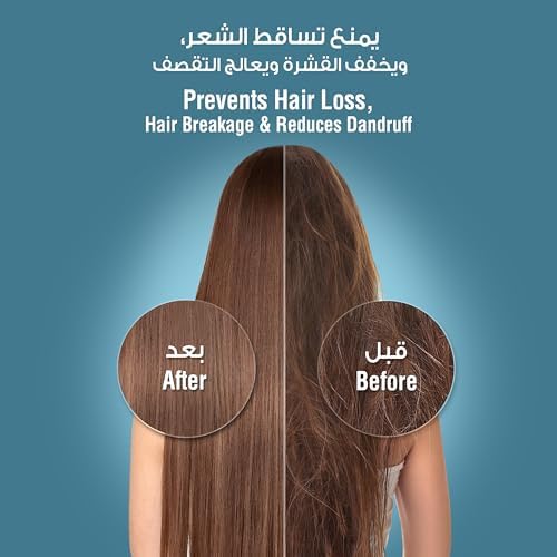 Blu Ionic Shower Head and Shower Filter - Handheld - Removes Chlorine & Harmful Pollutants - Prevent Hair Loss & Moisturize Your Skin, Chrome - Medaid International