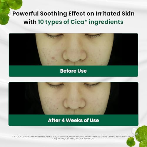 Dr.G Red Blemish Clear Soothing Korean Moisturizer Face Cream, 70ml - Cica Cream, Korean Skin Care Moisturizer, Korean Face Moisturizer, Facial Moisturizer, Korean Skincare, K Beauty Skincare Coreano|B0BRRB61K9