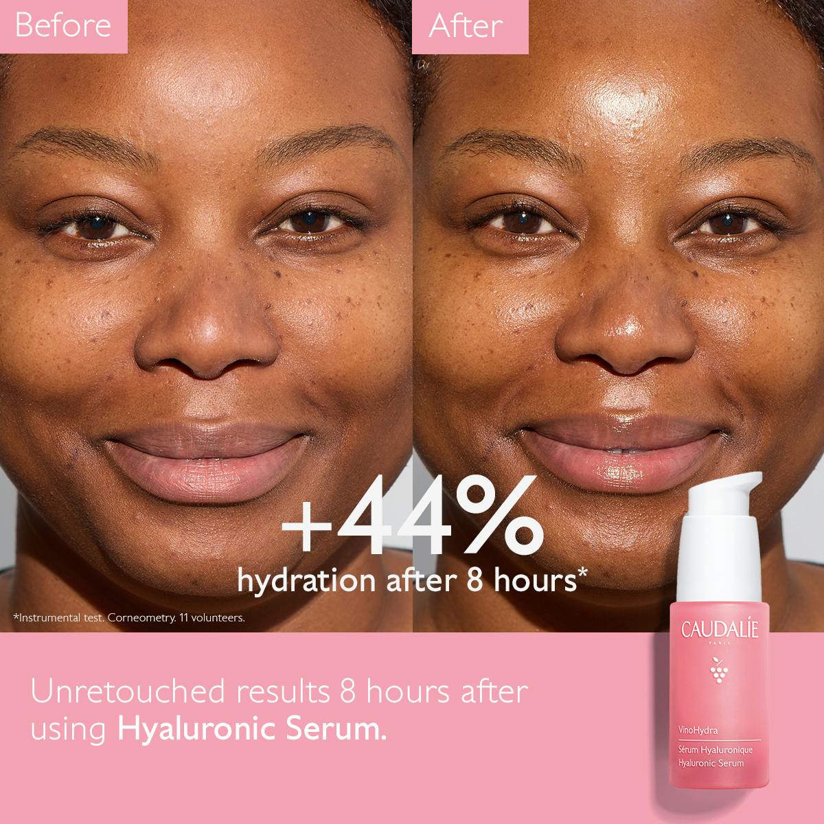 Hyaluronic Serum - Medaid