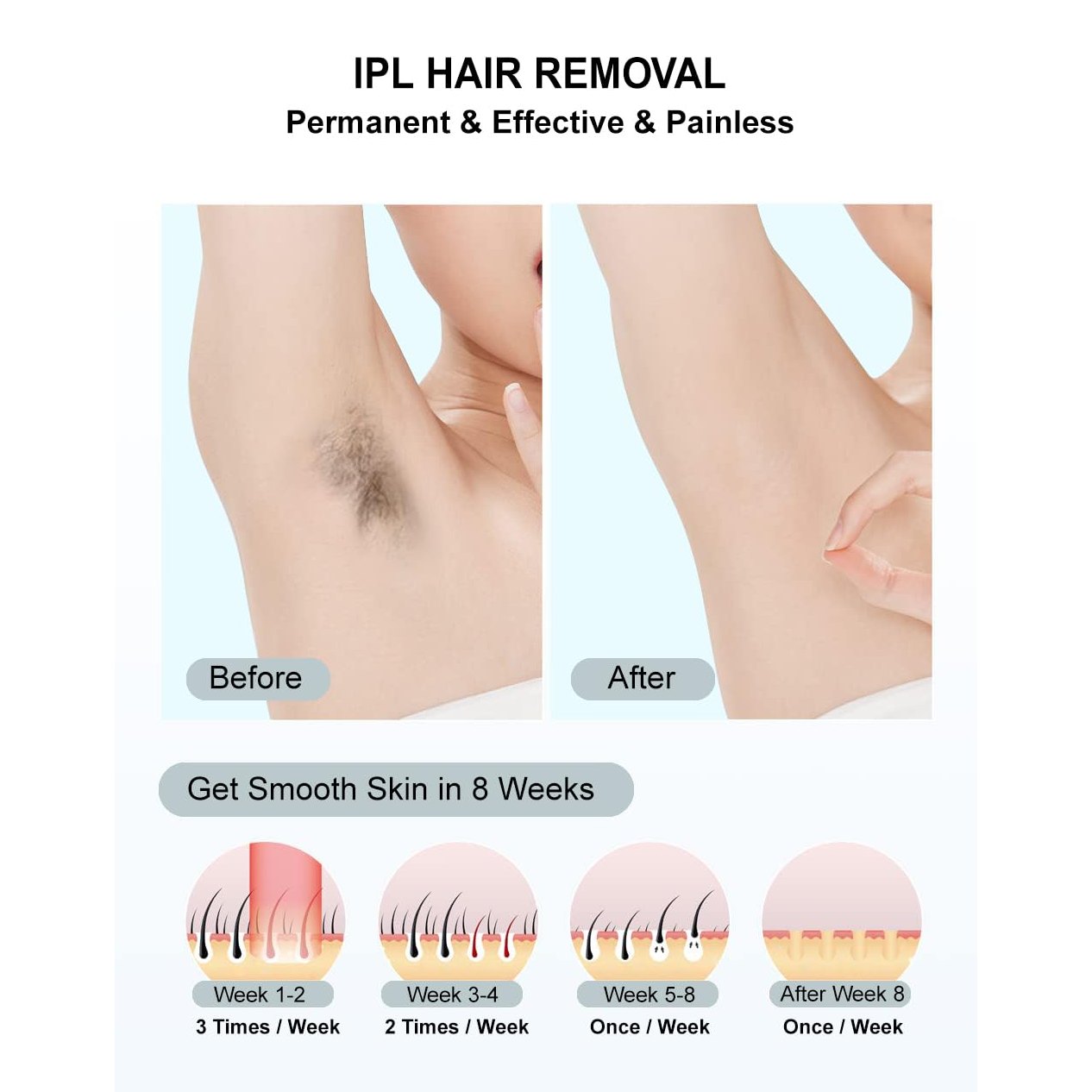 IPL Hair Removal,Laser Hair Removal At-Home for Women Men, 999,999 Flashes Permanent Removal Device on Facial Legs Arms Bikini Line - Medaid International