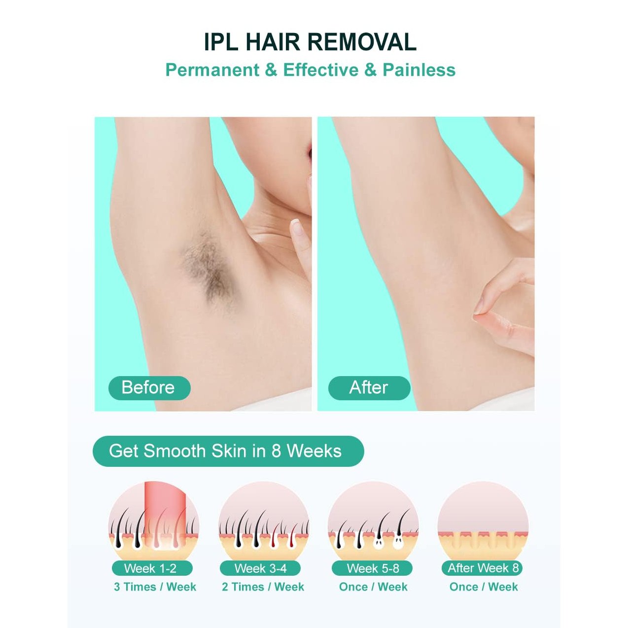 IPL Hair Removal,Laser Hair Removal At-Home for Women Men, 999,999 Flashes Permanent Hair Removal Device on Facial Legs Arms Bikini Line - Medaid International