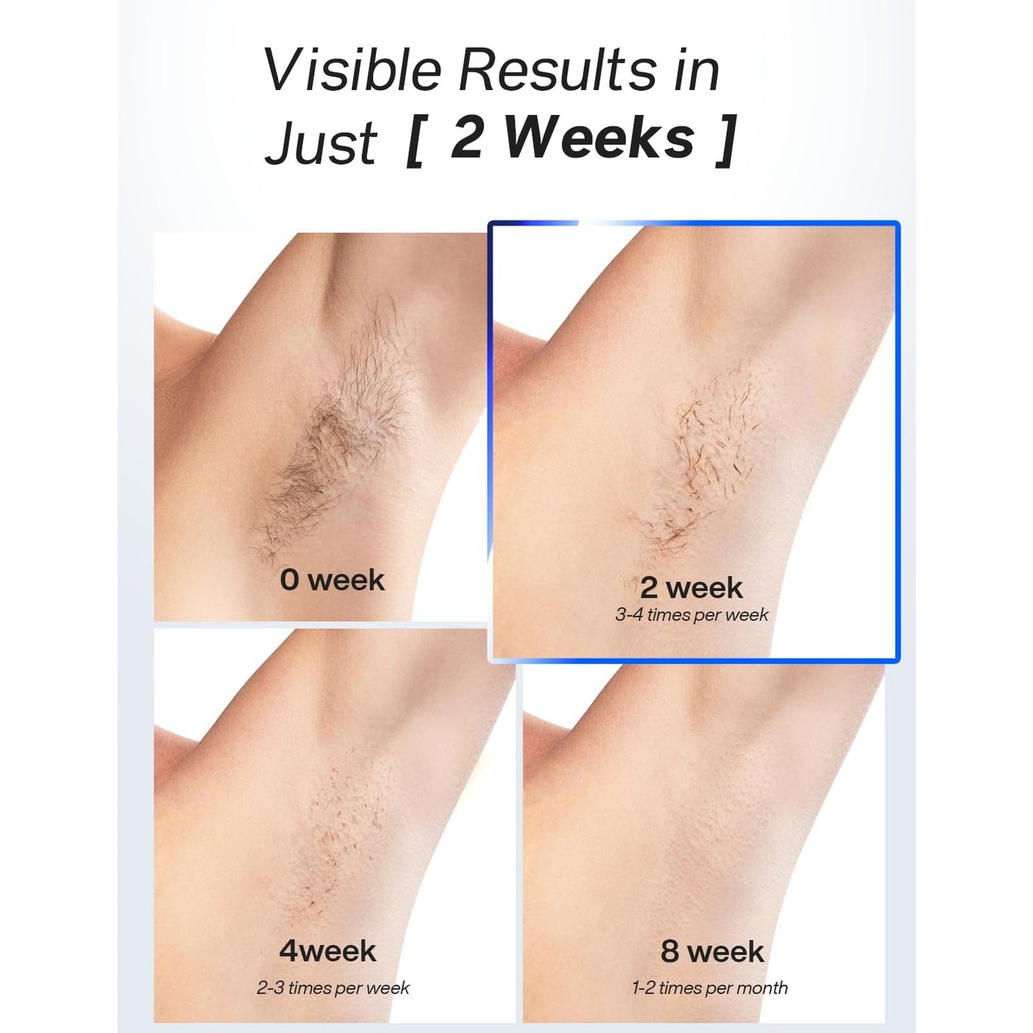 Blex Laser Hair Removal for Women and Men, IPL Laser Hair Removal Device with Permanent Results, Effective in 2 Weeks, Ultra-Fast 0.2s Light Emission, Painless at-home Hair Remover - Medaid International