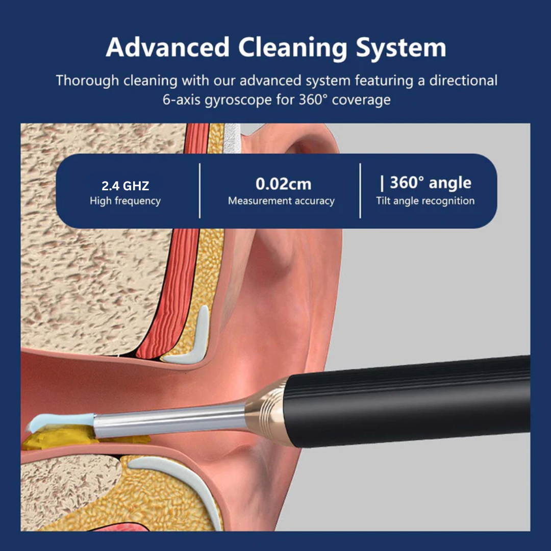 Ear Wax Removal Tool with Camera – HD Ear Cleaner with 6 LED Lights – Black - Medaid International