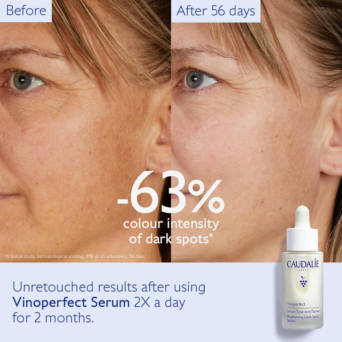 Dark Spot Brightening Serum Vitamin C Alternative - Medaid