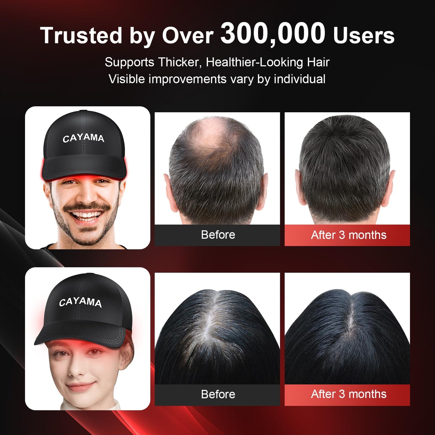 CAYAMA Red Light Therapy Cap for Hair – 510 LED Laser Hair Cap for Fuller, Healthier-Looking Hair, Rechargeable Light-Based Care Device for Men & Women - Medaid International