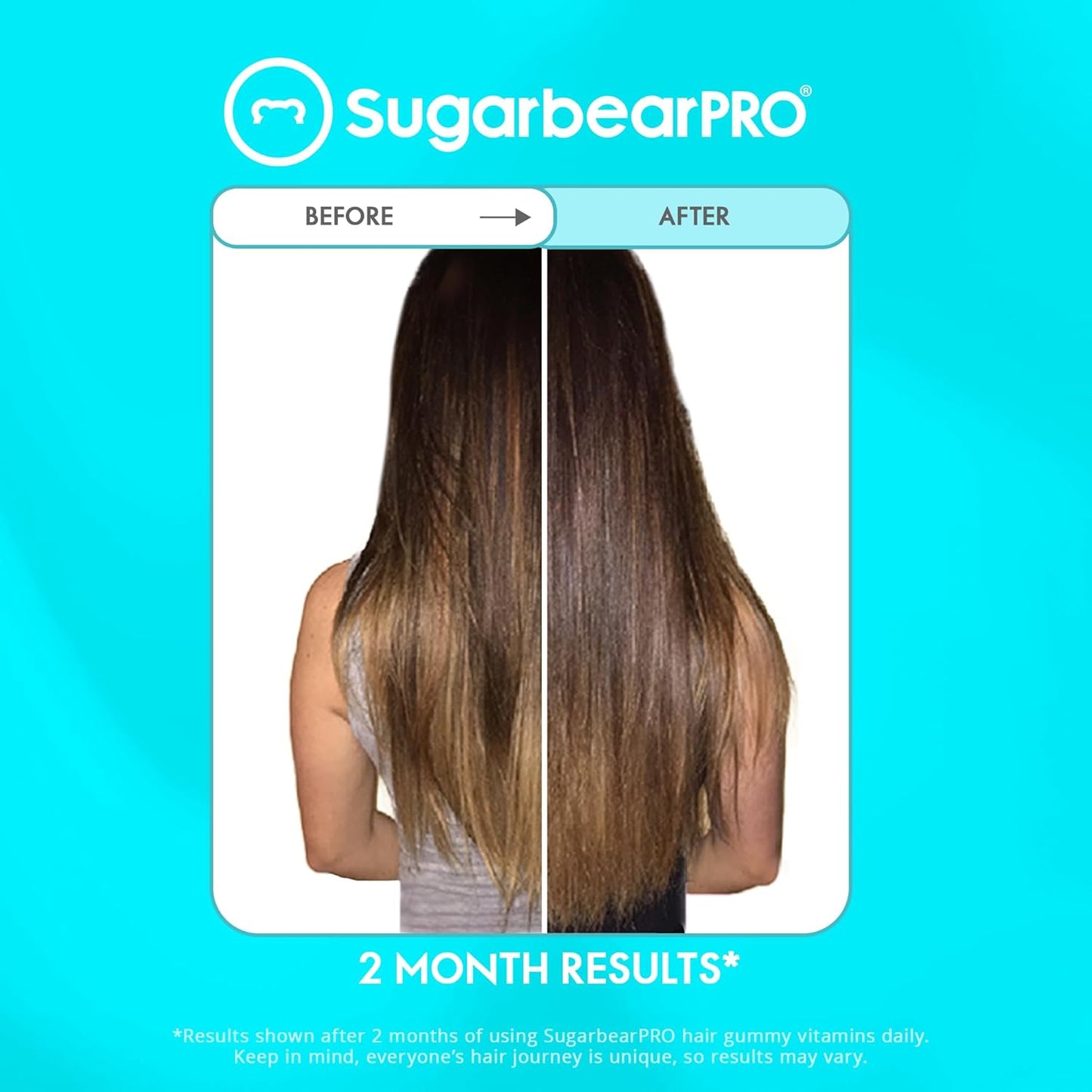 Sugarbear Pro Hair Vitamin Vegan Gummies - 3 Month Pack + Brush - Medaid International