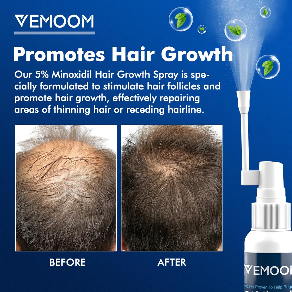 5% Minoxidil Hair Growth Spray for Women and Men, Effective Anti-Hair Loss Treatment for Regrowth, Extra Strength Scalp Solution, Thicker, Stronger and Longer Hair - 60ml*2 - Medaid International