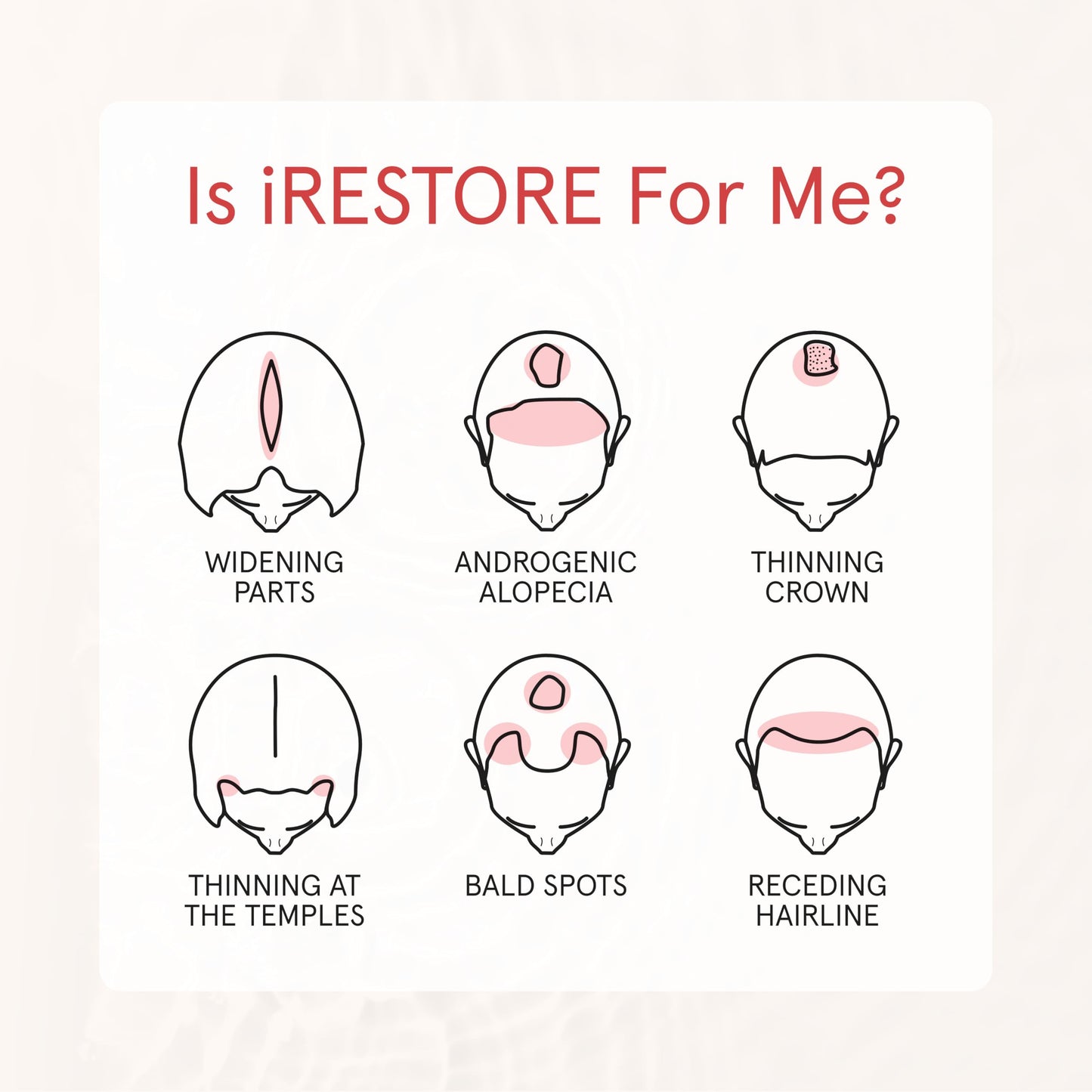 iRESTORE Biotin Hair Conditioner for Damaged Dry Hair - Good for Fine Hair Growth, Volumizing Thickening Conditioner with Ginseng & Argan Oil to Moisturize, Pair With Hair Loss Shampoo - Medaid International