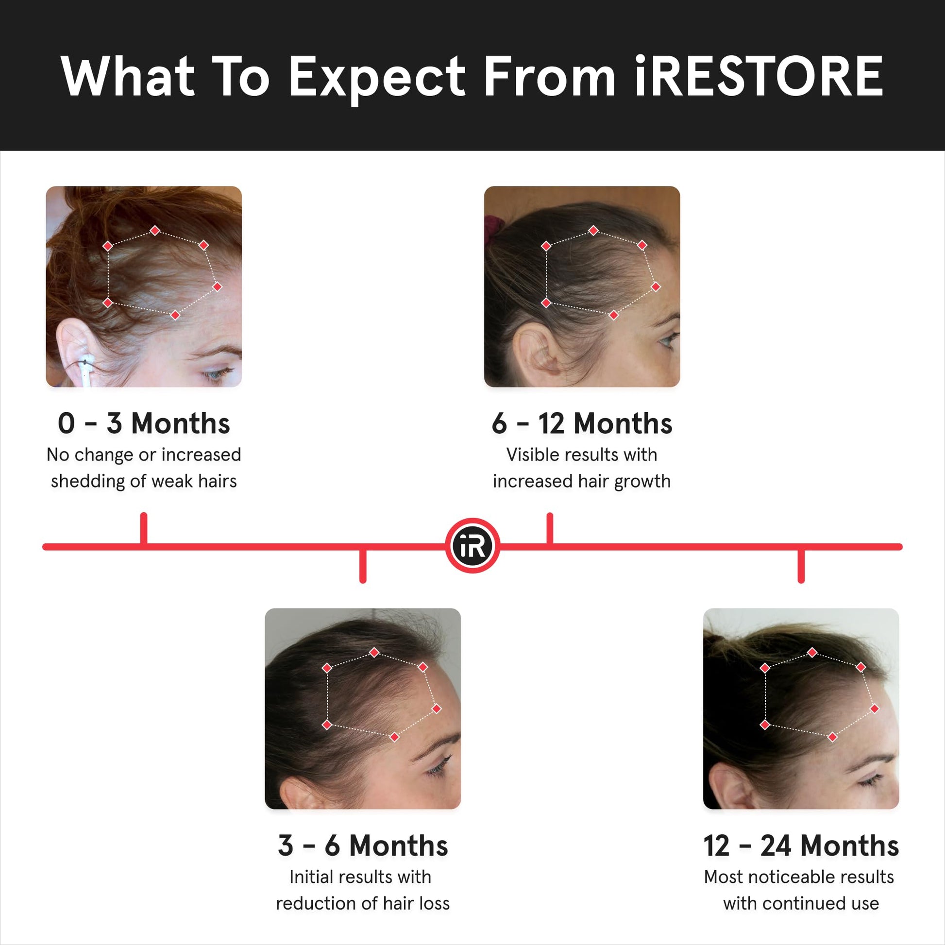 iRestore Essential Laser Hair Growth System + Rechargeable Battery Pack - FDA Cleared Hair Regrowth for Men & Women with Thinning Hair - Medaid International