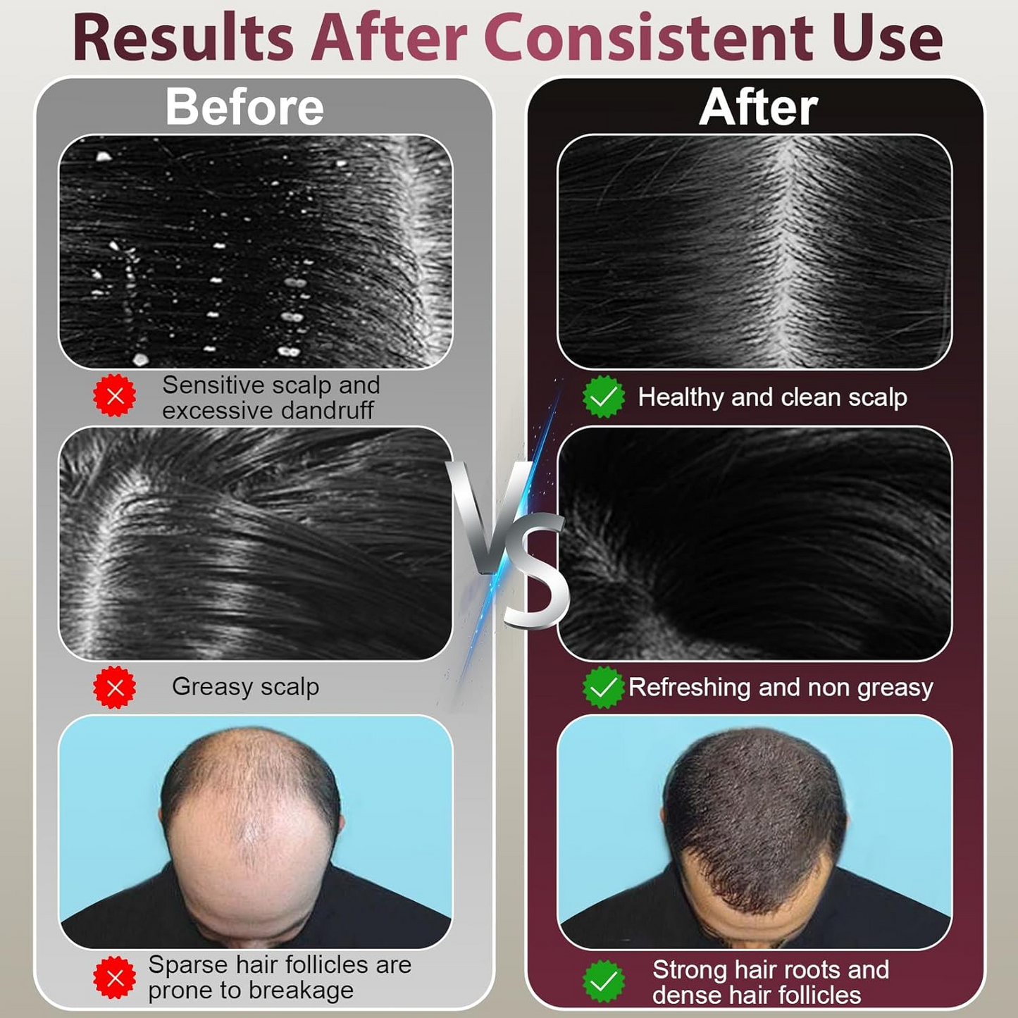 Laser Therapy Hair Growth Comb – Electric Scalp Massager & Hair Oil Applicator Waterproof - Medaid International