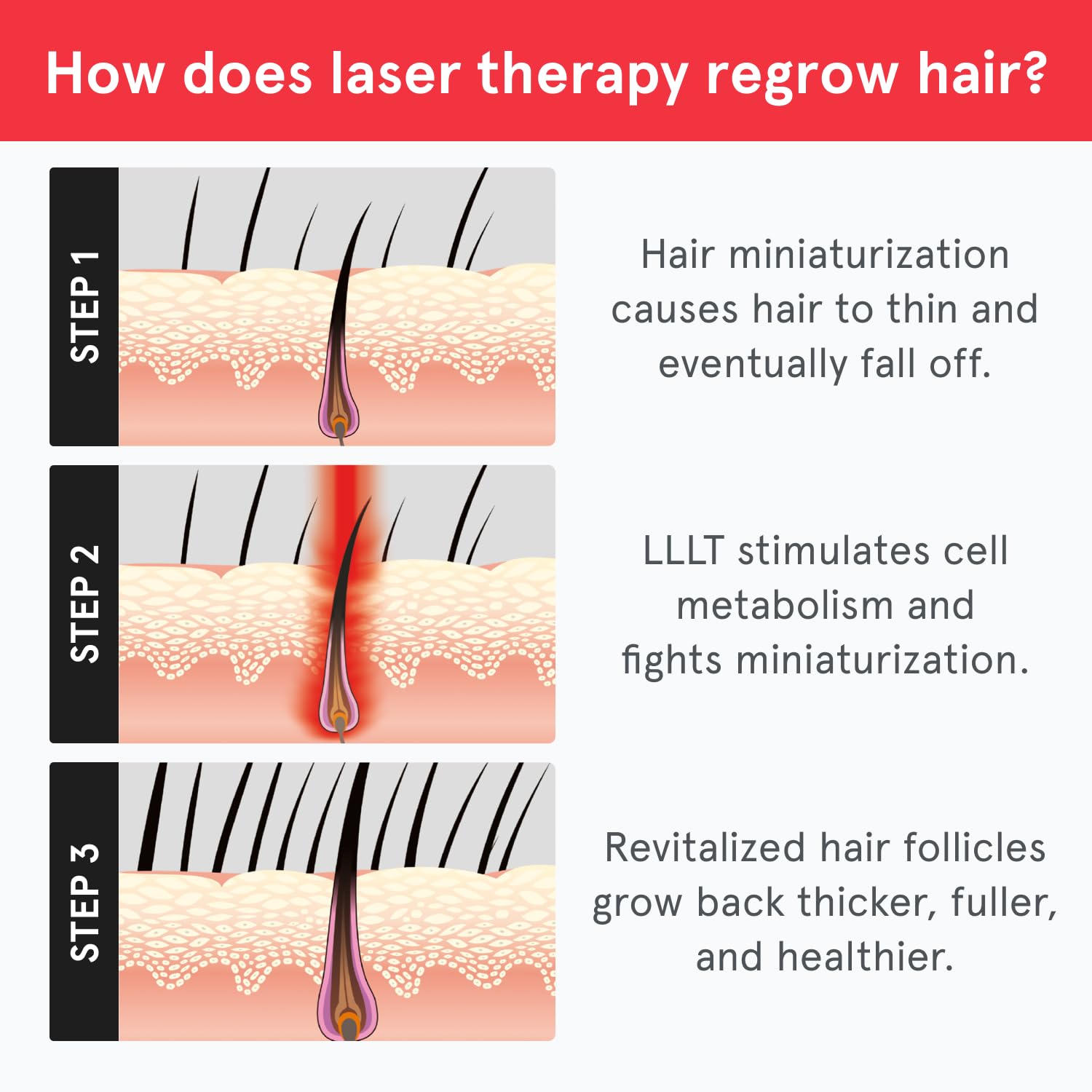 iRestore Essential - Laser Red Light Therapy for Hair Growth - FDA Cleared Hair Loss, Hair Thinning & Alopecia Treatment for Men & Women - Laser Cap for Hair Regrowth Stimulate Denser Fuller Hair - Medaid International