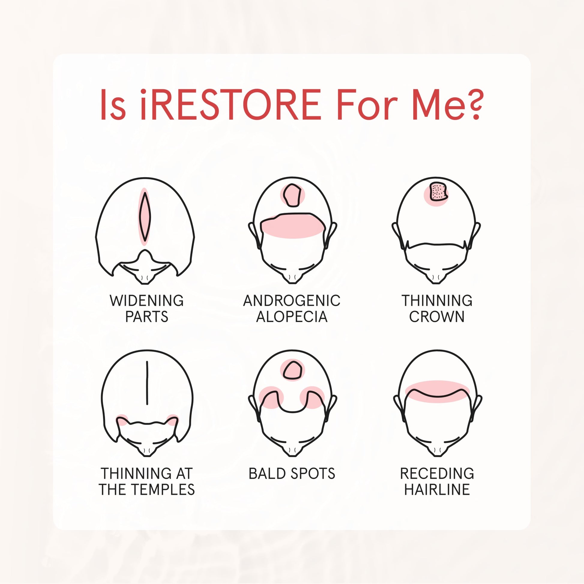 iRestore Anti Hair Loss and Thinning Shampoo - Biotin Formula for Hair Growth, Thickening and Volumizing for Men & Women - Medaid International