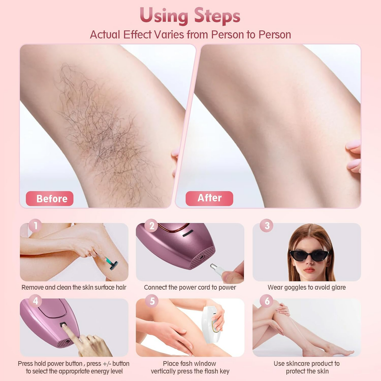 IPL Hair Removal Devices, Hair Removal, Laser Permanent Hair Removal, Laser Hair Remover, - Medaid International