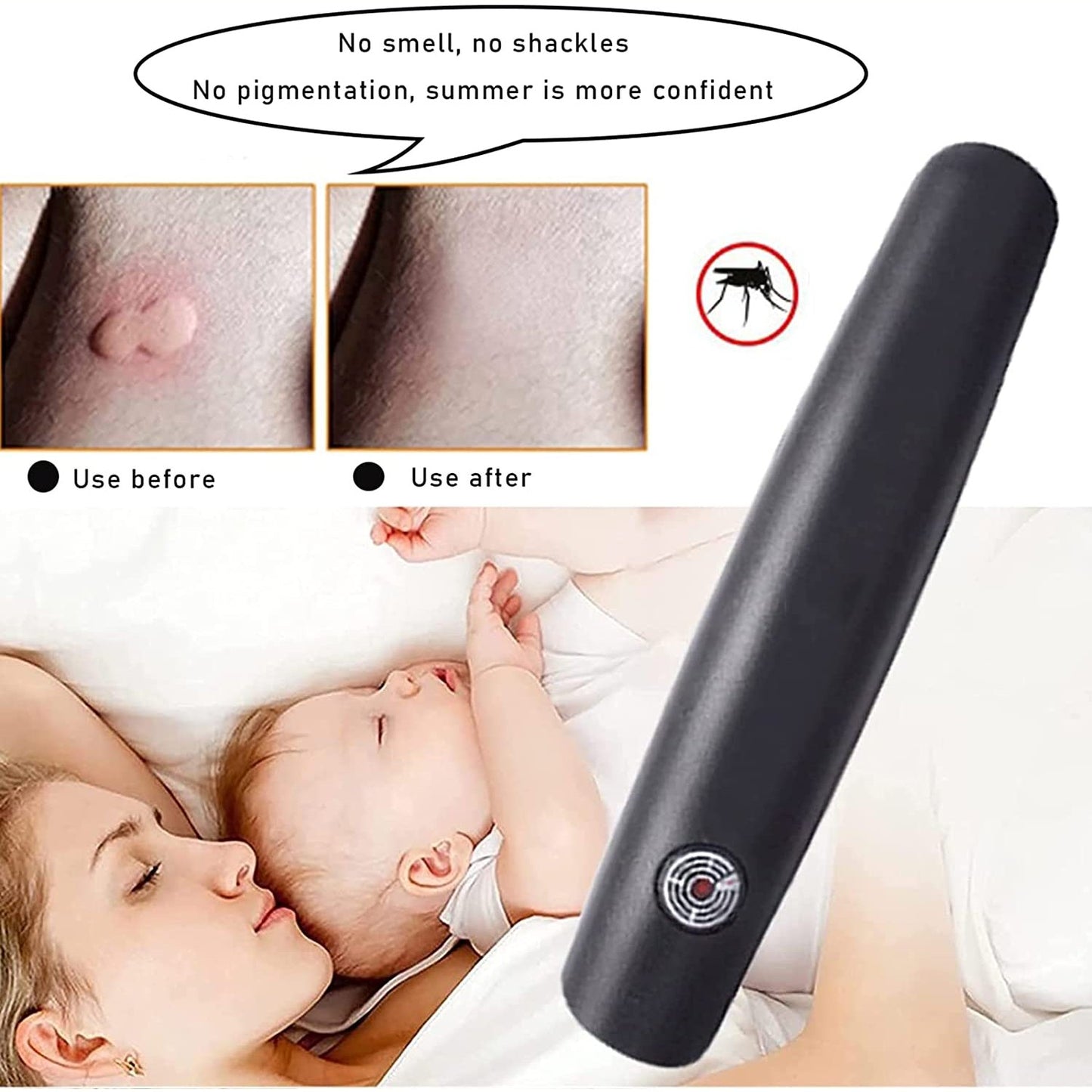 Mosquito Bite Helper   Mosquito and bug bite itch relief, insect sting and bite relief, anti-itch device - Medaid International