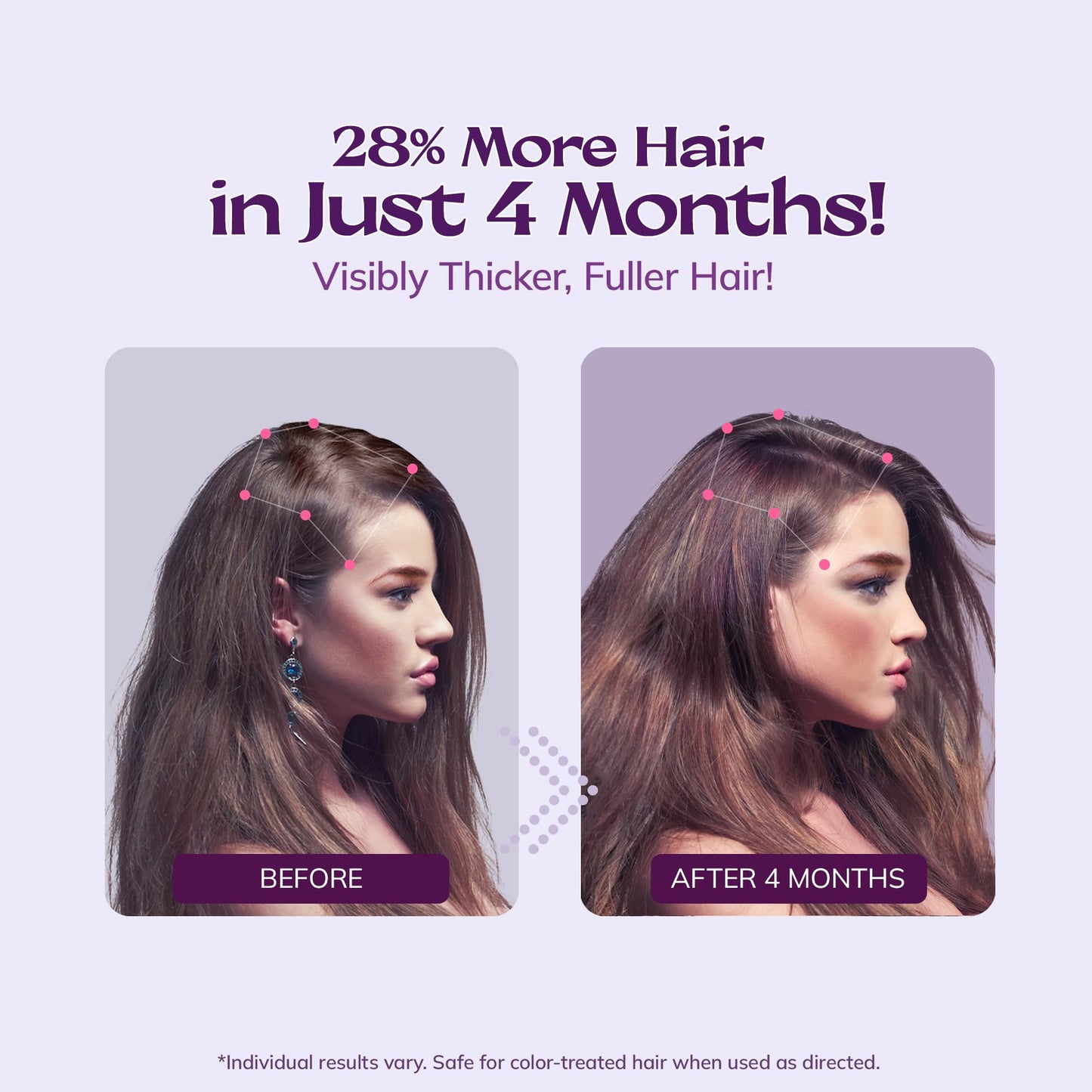 Women's 5% Minoxidil Spray for Hair Growth: RootStim Extra Strength Minoxidil with Rosemary & Biotin for Thinning Hair Regrowth and Fuller Hair 60 ML - Medaid International