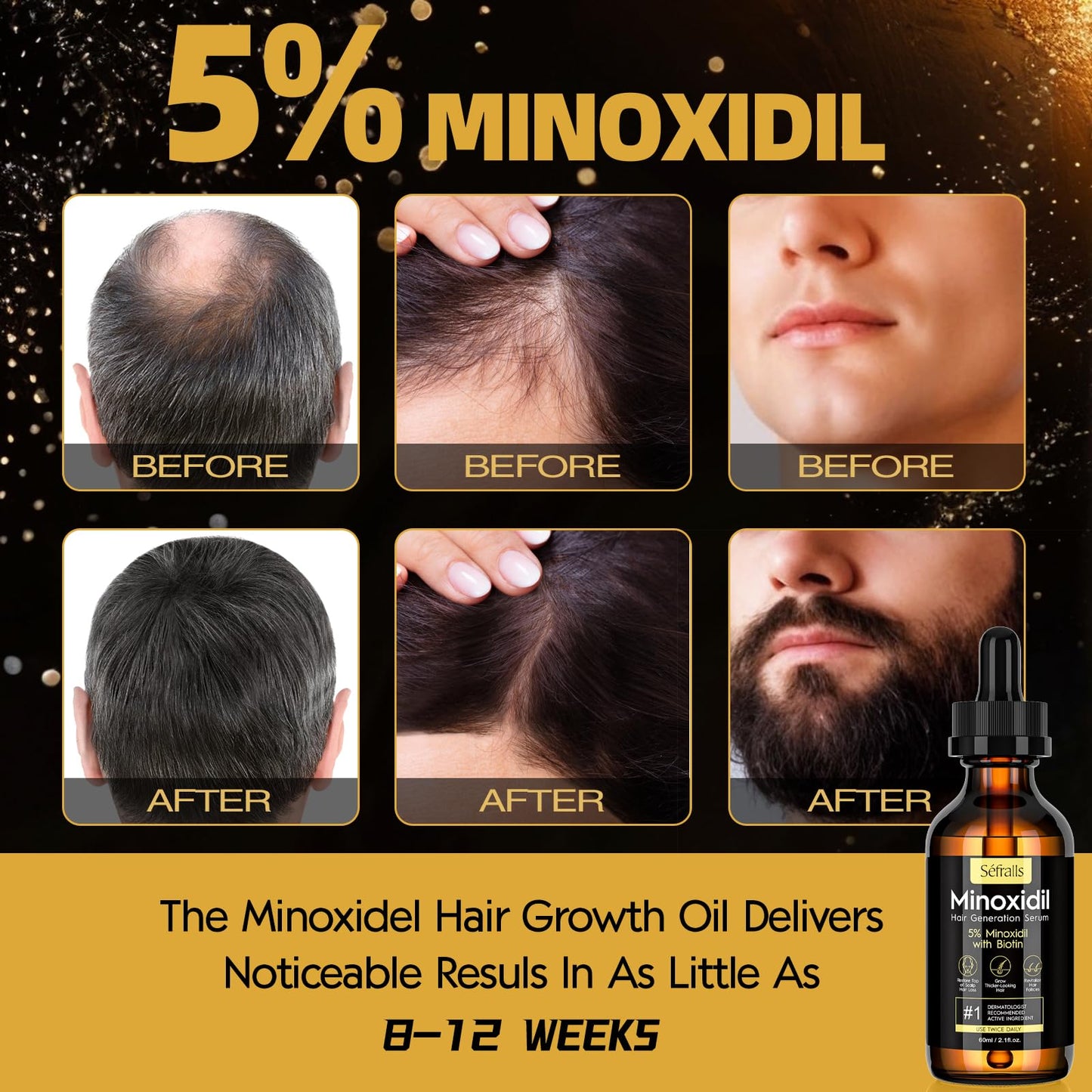 5% Minoxidil Hair Growth Serum Oil For Men and Women, Biotin Hair Serum, Safest Hair Regrowth Treatment, Prevent Scalp Hair Loss 60ml / 2.11 fl.oz - Medaid International