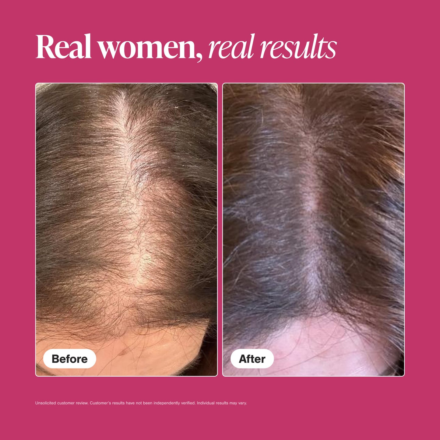 Viviscal Hair Growth Supplements For Women For Thicker, Fuller Hair, Nourishes Thinning & Loss, With Proprietary Collagen Complex, 60 Tablets, 1 Month Supply - Medaid International