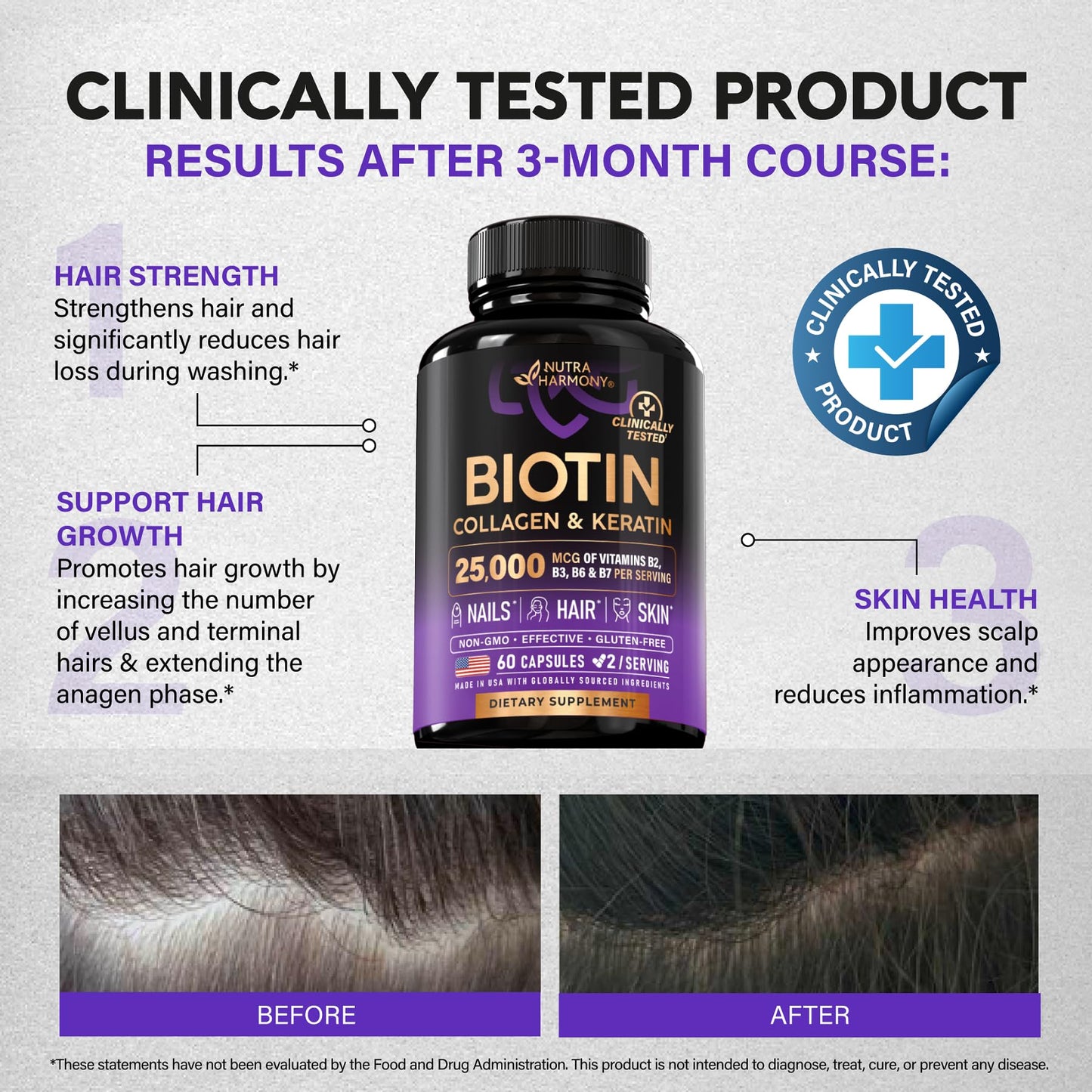 Biotin | Collagen | Hyaluronic Acid | Keratin - Clinically Tested Supplement - Hair Growth Support, Skin & Nails - 25000 mcg Vitamins B2, B3, B6 & B7 + B1 - Made in USA - Women & Men | 60 Capsules - Medaid International