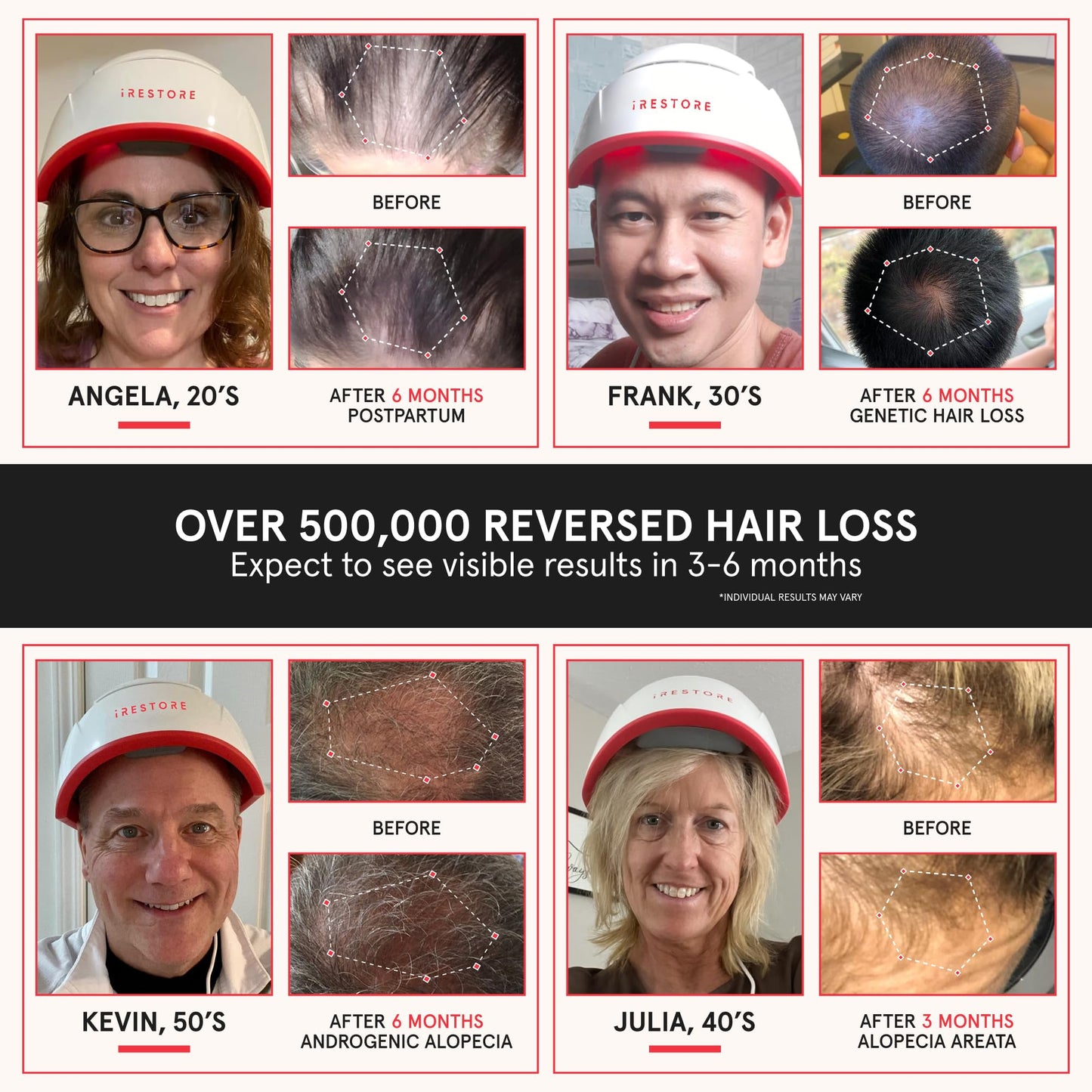 Hair Boost System Bundle: Advanced Hair Growth Supplement + Pro Hair Device - Medaid International