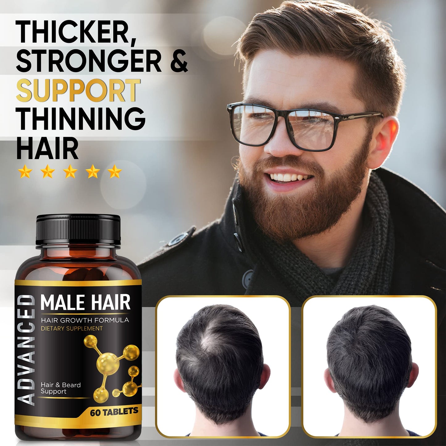 Hair Growth Vitamins For Men-Anti Hair Loss Support Vitamins Pills & Dht Blocker For Men.Regrow Hair & Beard Growth Supplement For Thicker Fuller & Stronger Hair. Support Thinning Hair With Biotin. - Medaid International