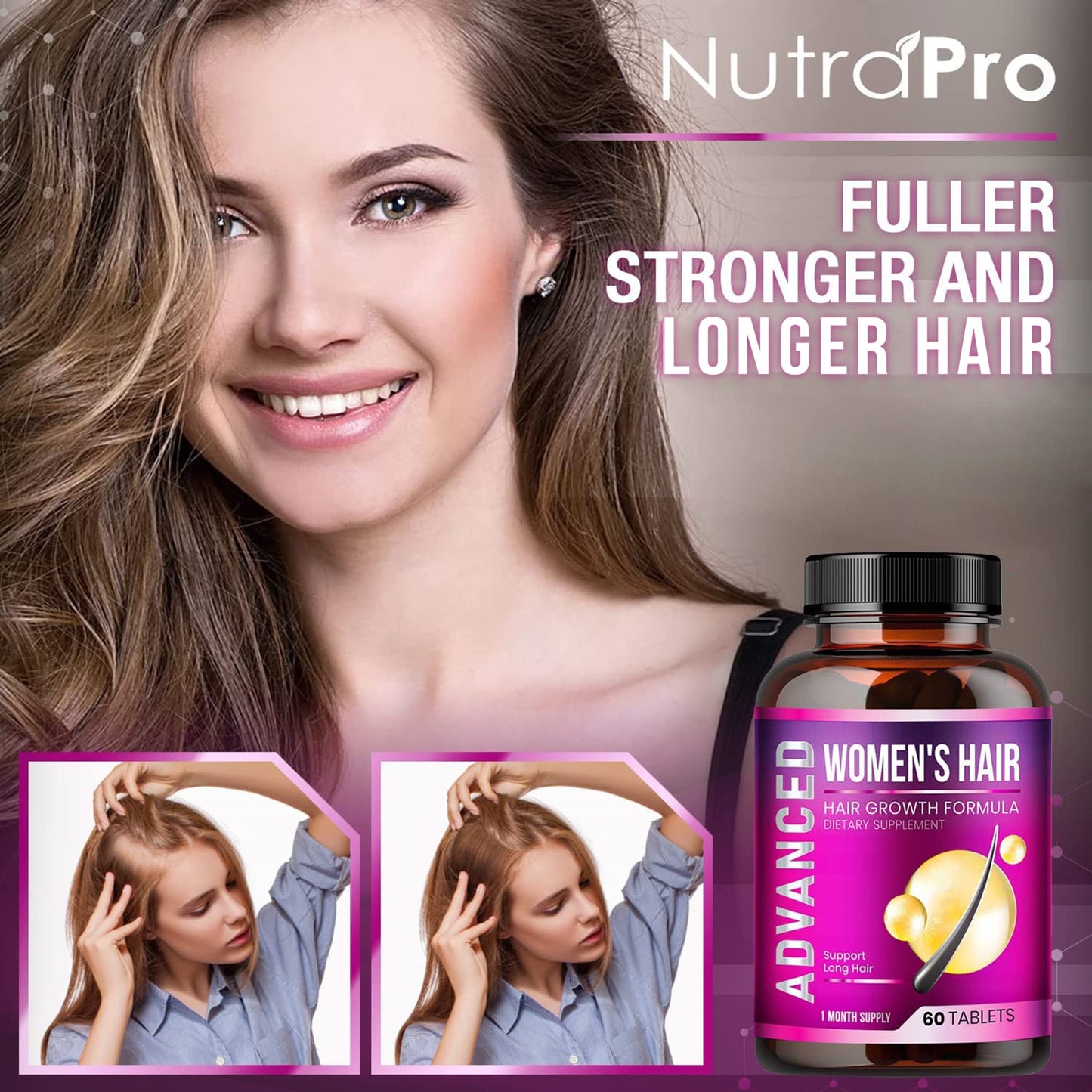 Hair Growth Vitamins for Women - Hair Vitamins for Thinning Hair for Women .Regrow & Regrowth Hair Supplement with Dht Blocker,Biotin & Saw Palmetto for Women.Volumize,Thicker,Longer Hair. - Medaid International