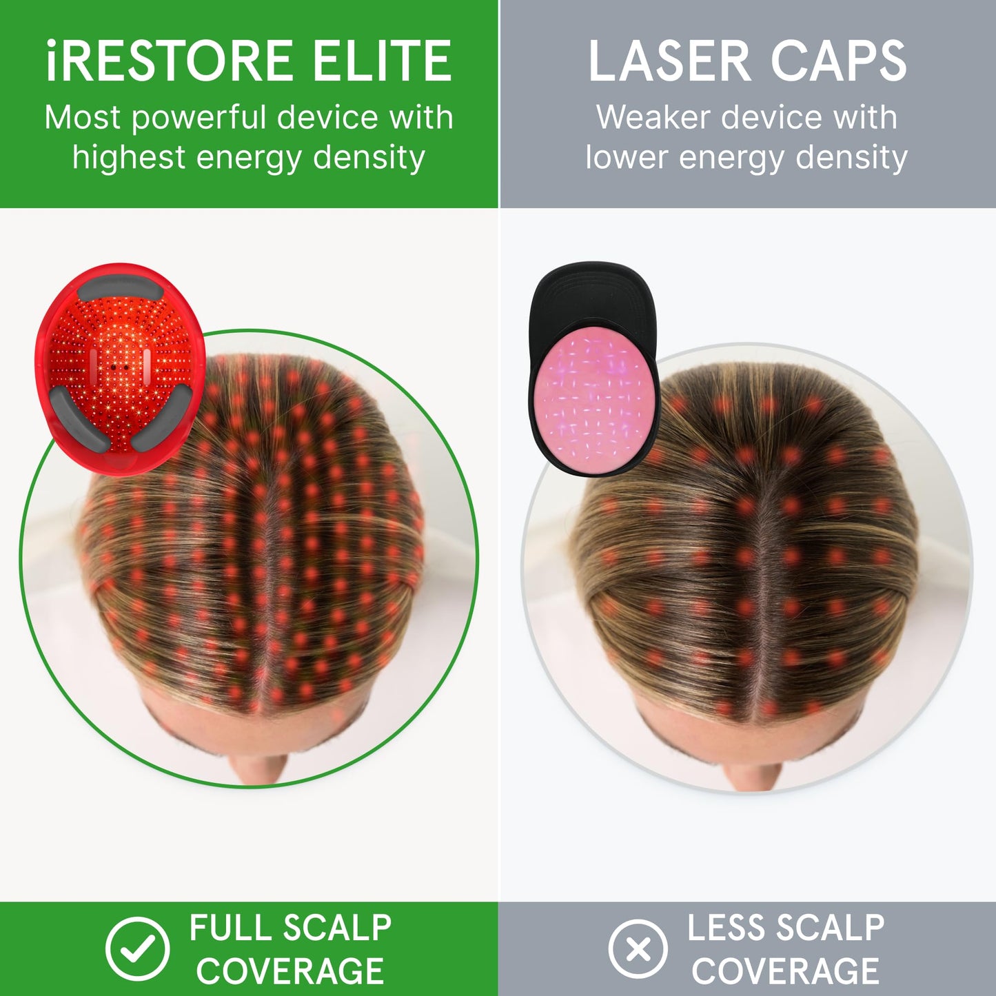 iRestore Elite + Rechargeable Battery Pack - Laser Red Light Therapy for Hair Growth - FDA Cleared Hair Loss, Hair Thinning Treatment for Men & Women - Hair Regrowth Laser Cap - 500 Lasers & LEDs - Medaid International