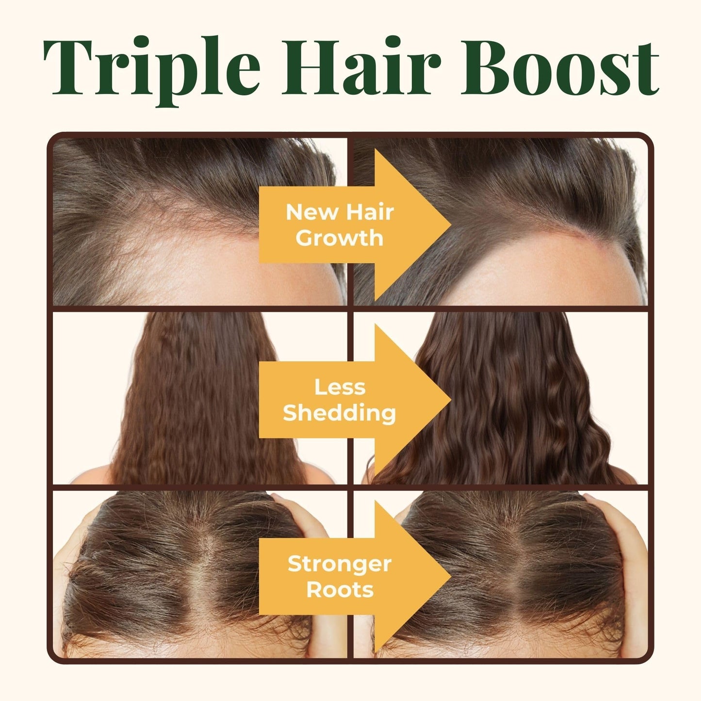 Heebin's Hair Growth Supplements with Biotin 4000 mcg, DHT Blocker and Collagen, for Hair Loss, Thinning and Regrowth, 60 Tablets, 2 Month Supply - Medaid International