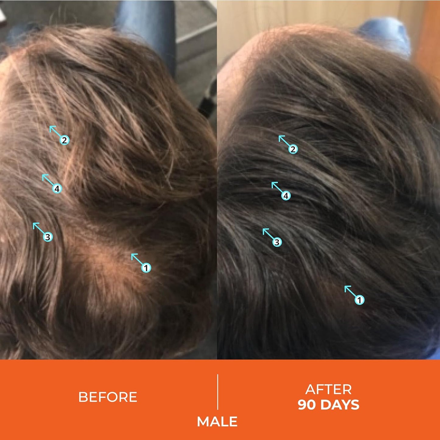 DS Laboratories Revita - Hair Growth and Thickening Shampoo with DHT Blocker, Biotin for Hair Regrowth Treatment for Women and Men - Medaid International