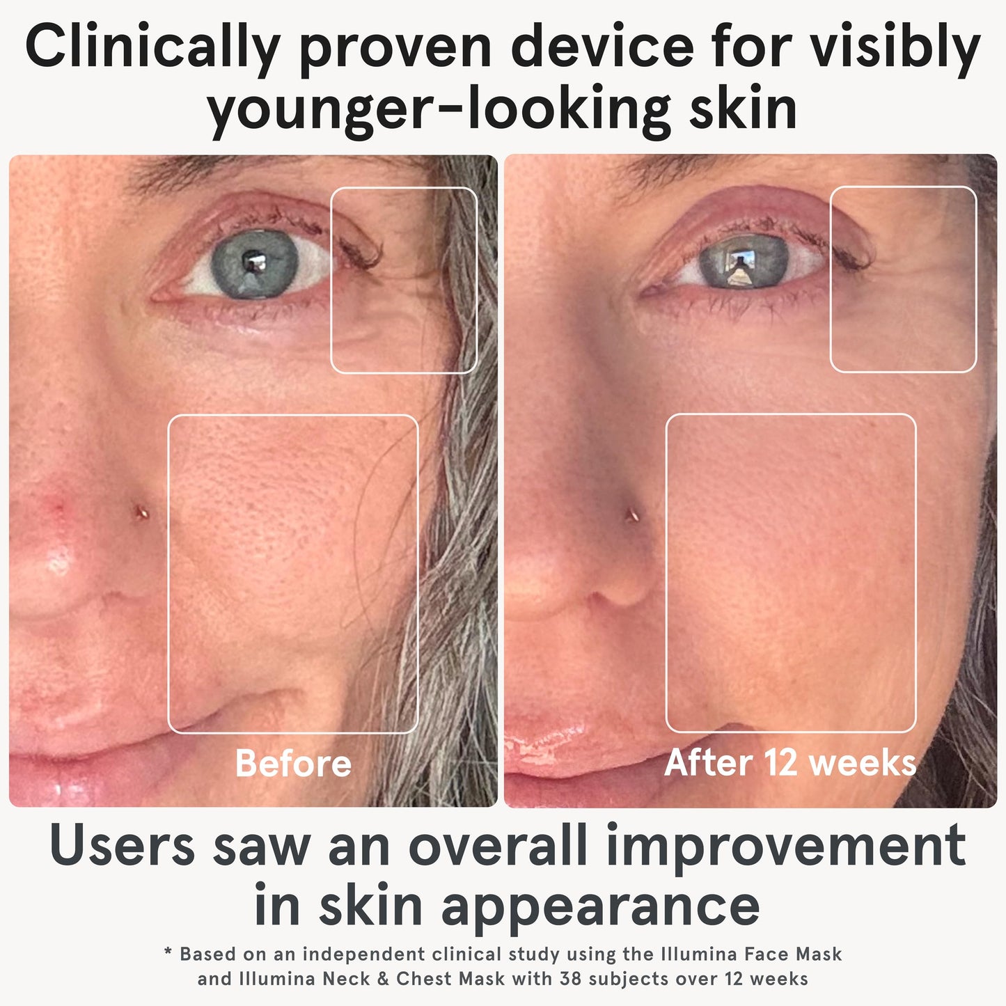 iRestore Red Light Therapy for Face - Anti Aging LED Face Mask for Youthful Radiant Skin with Reduced Wrinkles, Fine Lines - Red, Blue & Infrared Therapy Mask - Facial Skincare Device with 360 LEDs - Medaid International