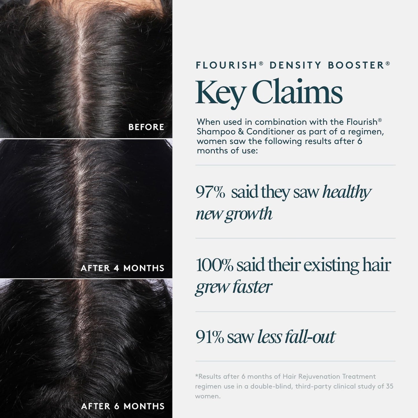 Virtue Flourish Hair Thinning Density Booster Spray Treatment, Hair Growth Product Thickens Hair, Sulfate Free, Color Safe - Medaid International