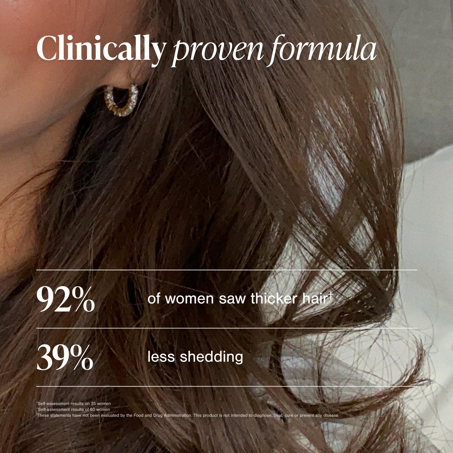 Viviscal Hair Growth Supplements For Women For Thicker, Fuller Hair, Nourishes Thinning & Loss, With Proprietary Collagen Complex, 60 Tablets, 1 Month Supply - Medaid International