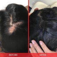 Hairtamin Advanced Formula - Medaid International