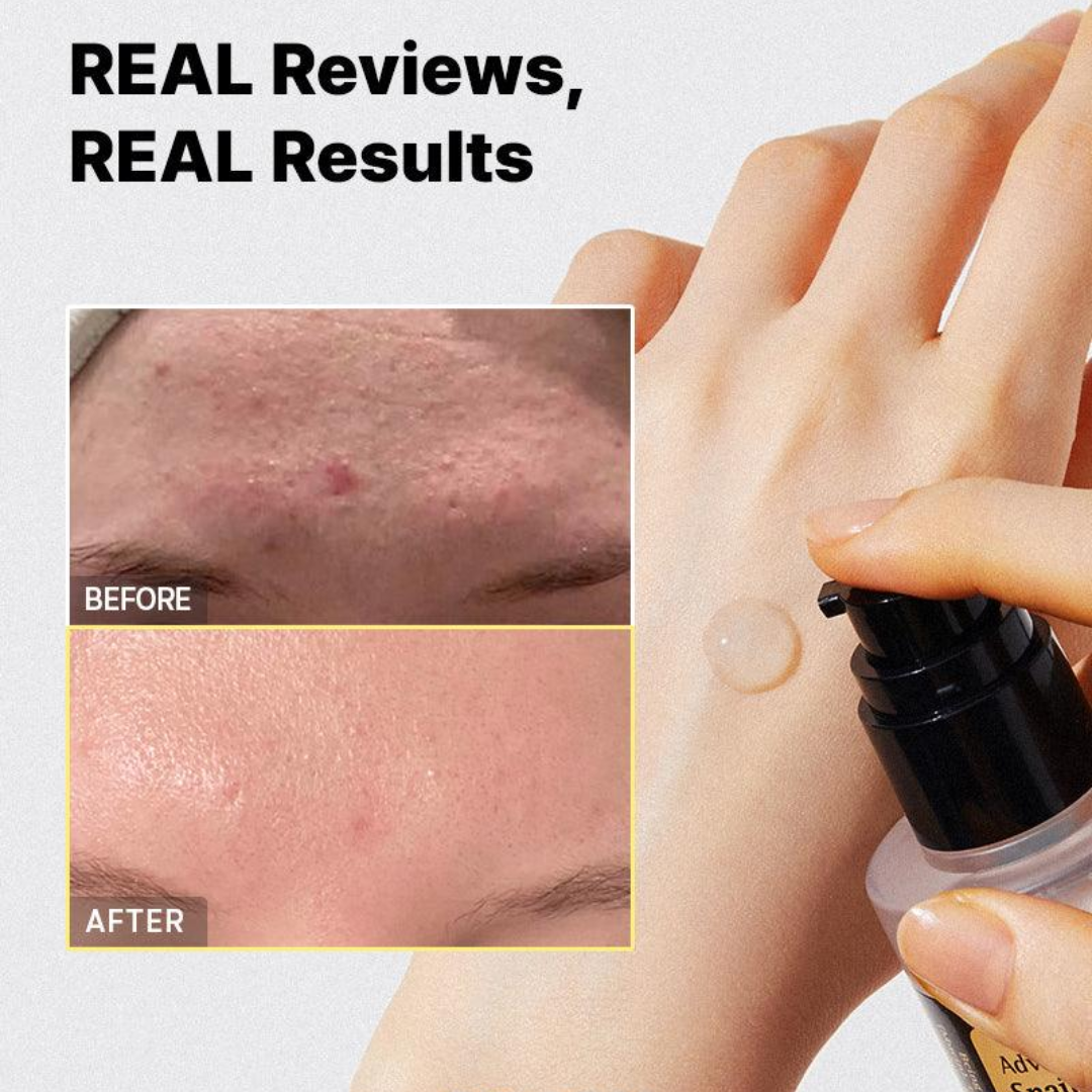 Cosrx Advanced Snail 96 Mucin Power Essence - Medaid