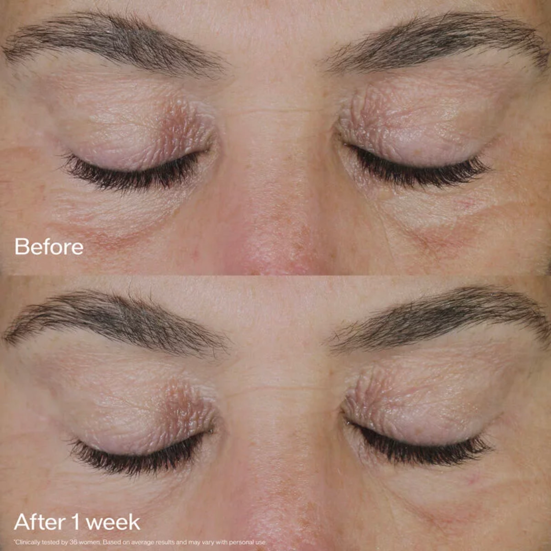 Shiseido Vital Perfection Ultra Lifting & Firming Eye Cream - Medaid International