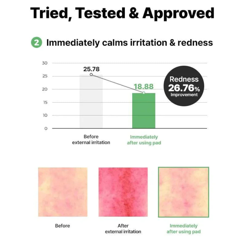 cosrx-one-step-green-calming-pad-70-pads - Medaid International