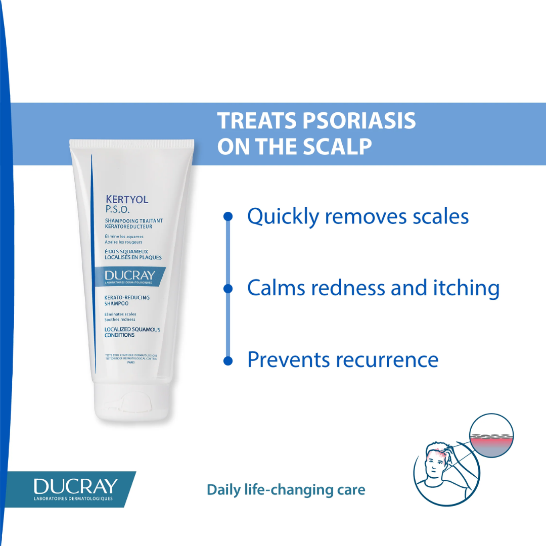Ducray Kertyol Psoriasis Kerato-Reducing Shampoo 200ml - Medaid International