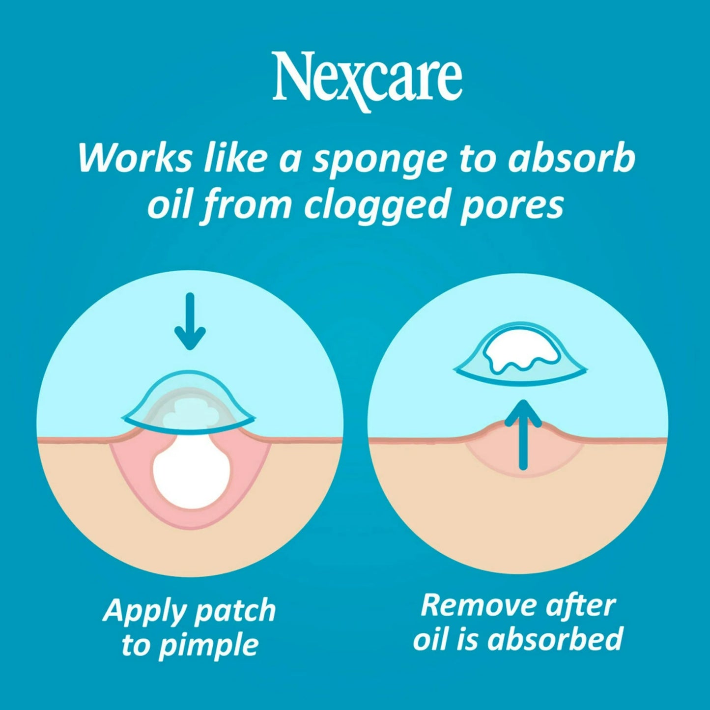 Nexcare Acne Cover for Clogged Pores - 36 Acne Covers - Medaid