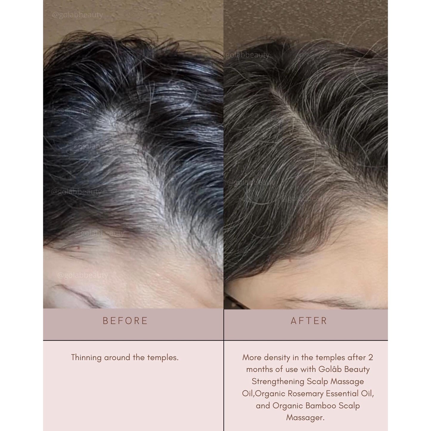 GolâbGrowth Bundle - Medaid International