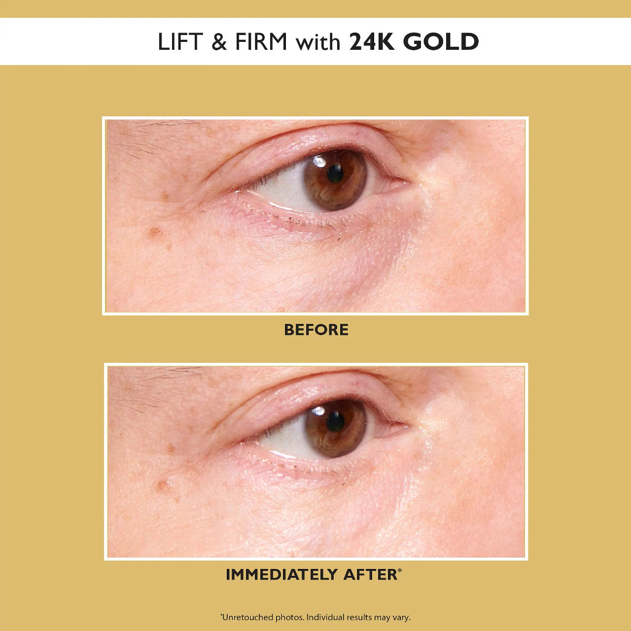 PETER THOMAS ROTH - 24K Gold Pure Luxury Lift & Firm EYE PATCHES | 30 pairs - 60 patches - Medaid