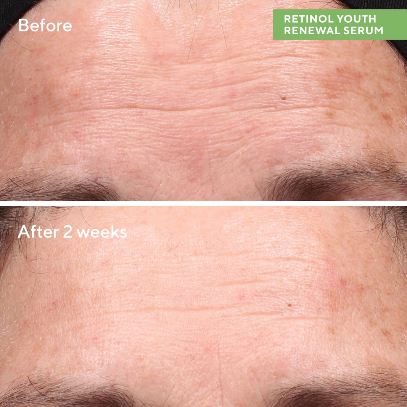 Murad - Retinol Youth Renewal Serum - Medaid