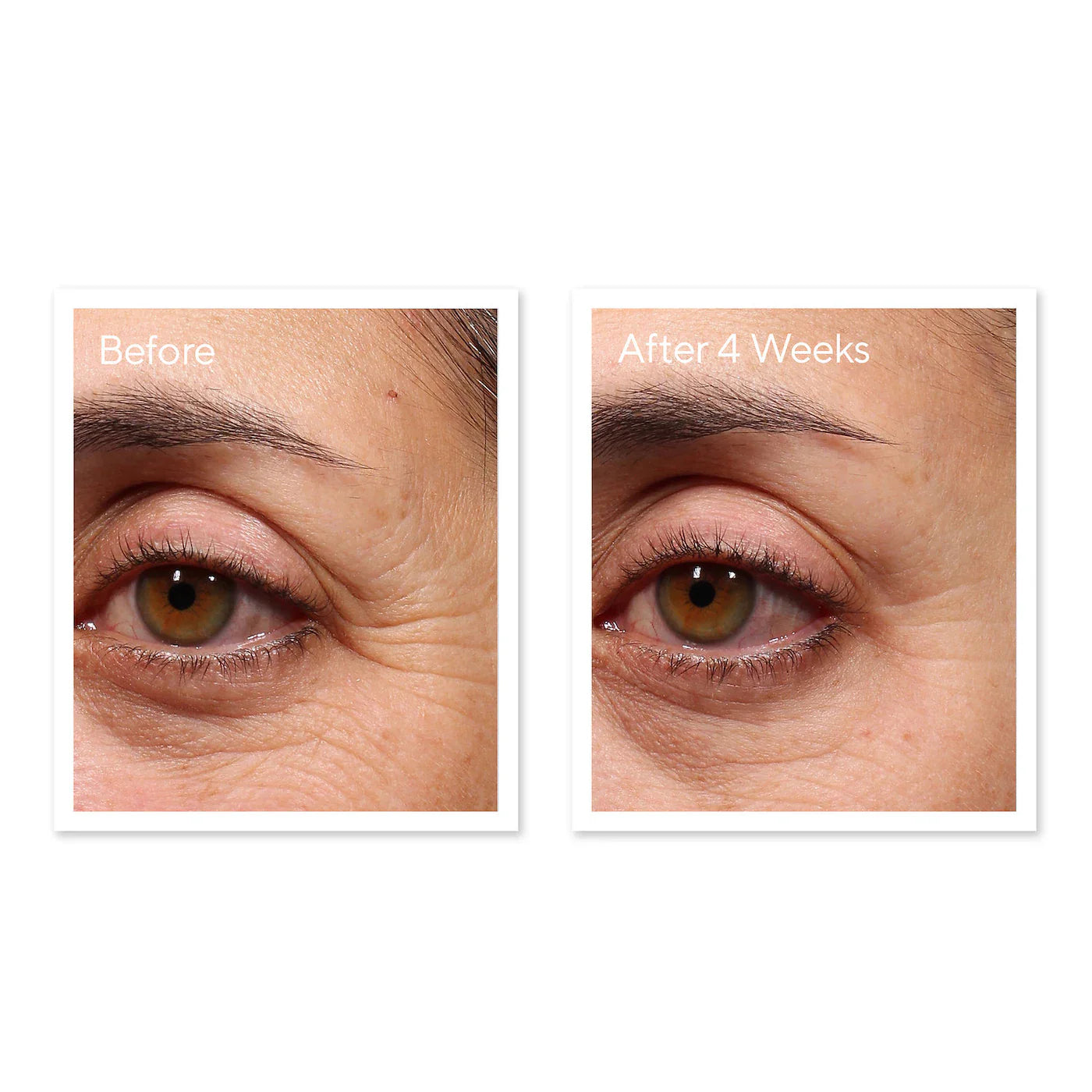 Murad - Retinol Youth Renewal Eye Serum | 15 ML - Medaid