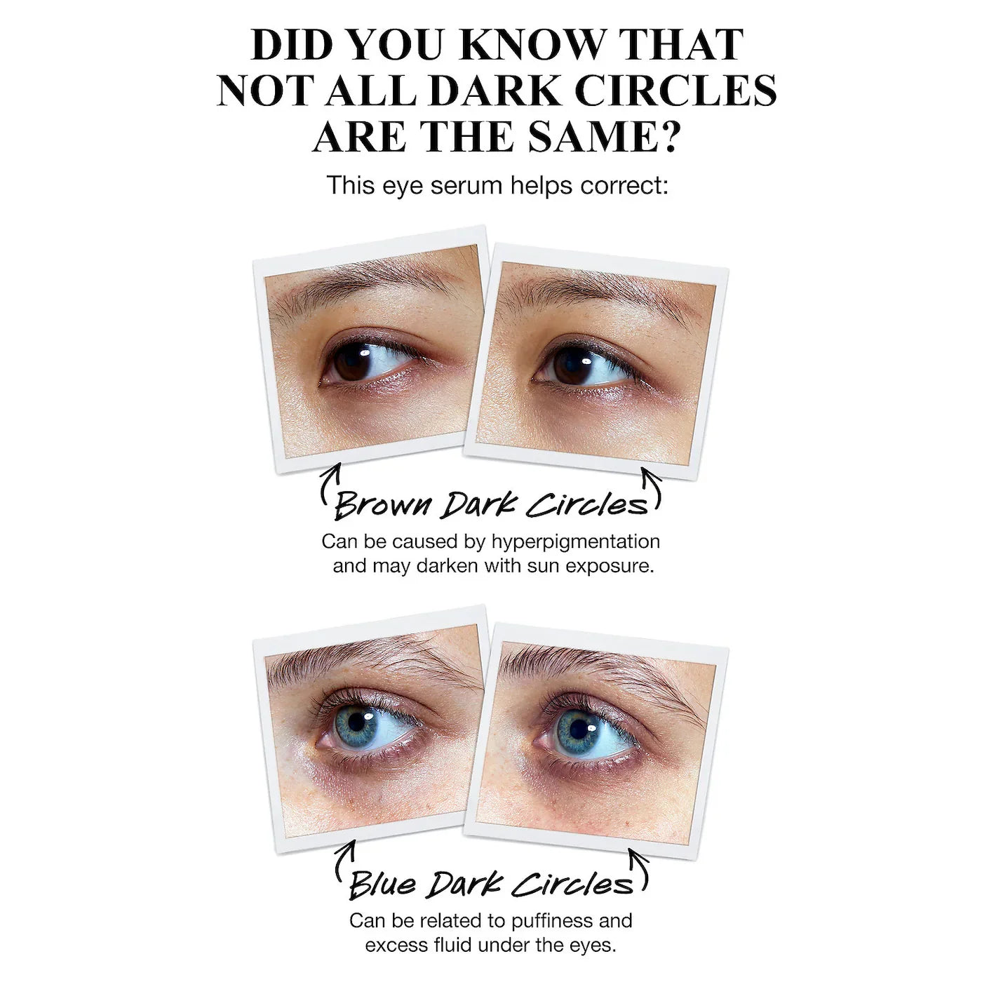 Kiehl's - Powerful-Strength Dark Circle Reducing Vitamin C Eye Serum | 15 mL - Medaid International