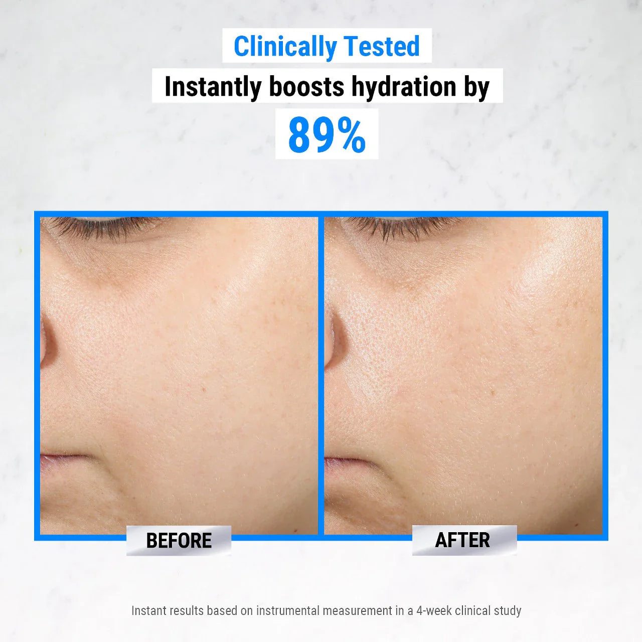 Kiehl's - Ultra Pure Hyaluronic Acid 1.5% Serum | 30 mL - Medaid International