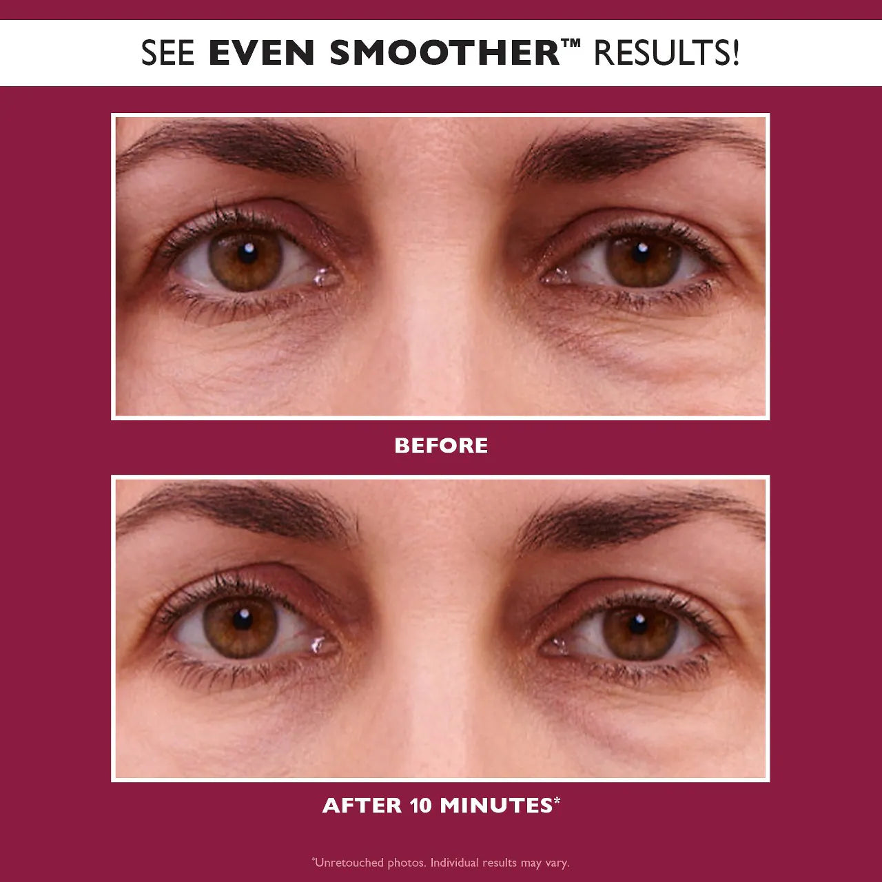 PETER THOMAS ROTH - EYE SMOOTHER GLYCOLIC RETINOL EYE PATCHES | 30 Pairs / 60 Patches - Medaid International