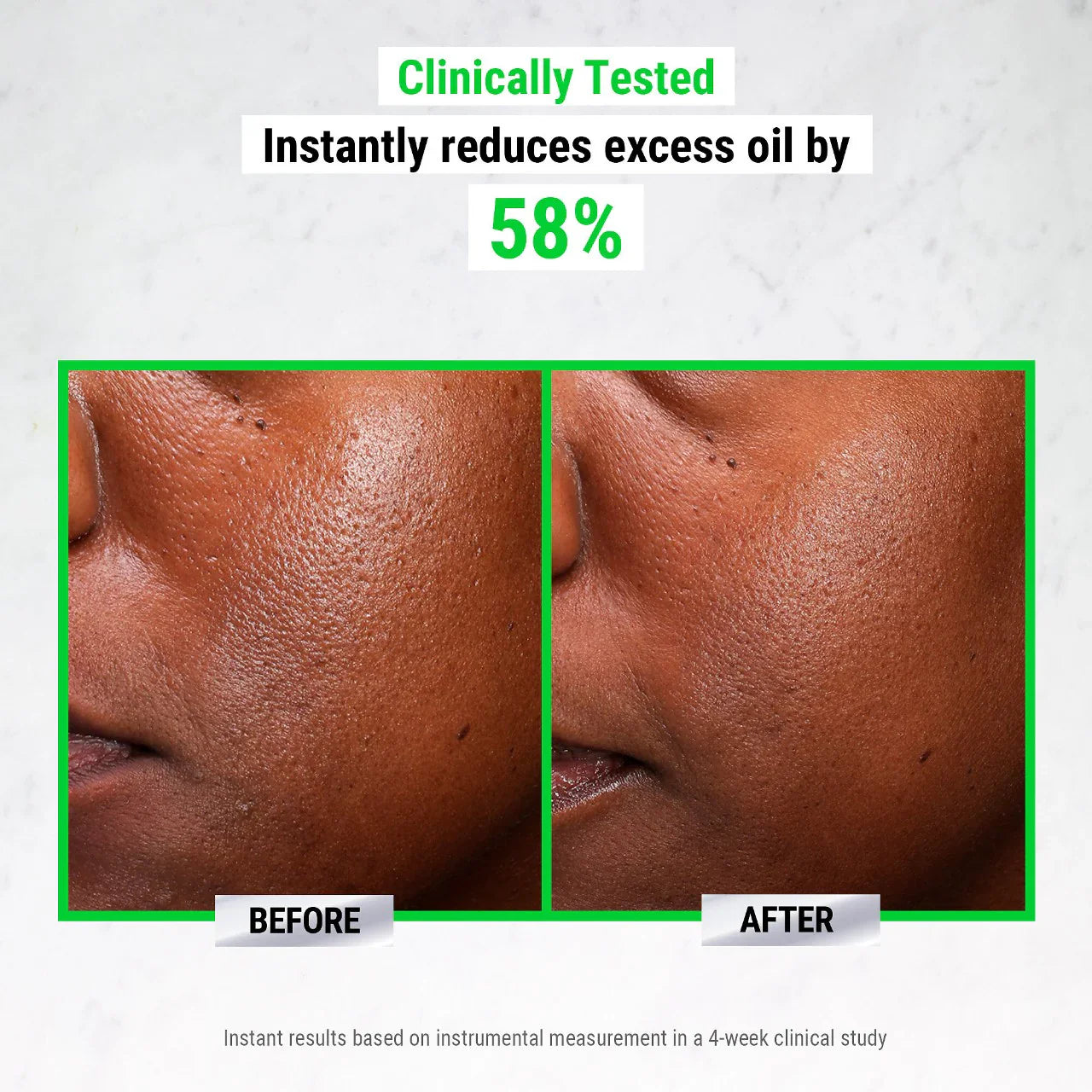 Kiehl's - Ultra Pure High-Potency 5.0% Niacinamide Serum | 30 mL - Medaid International