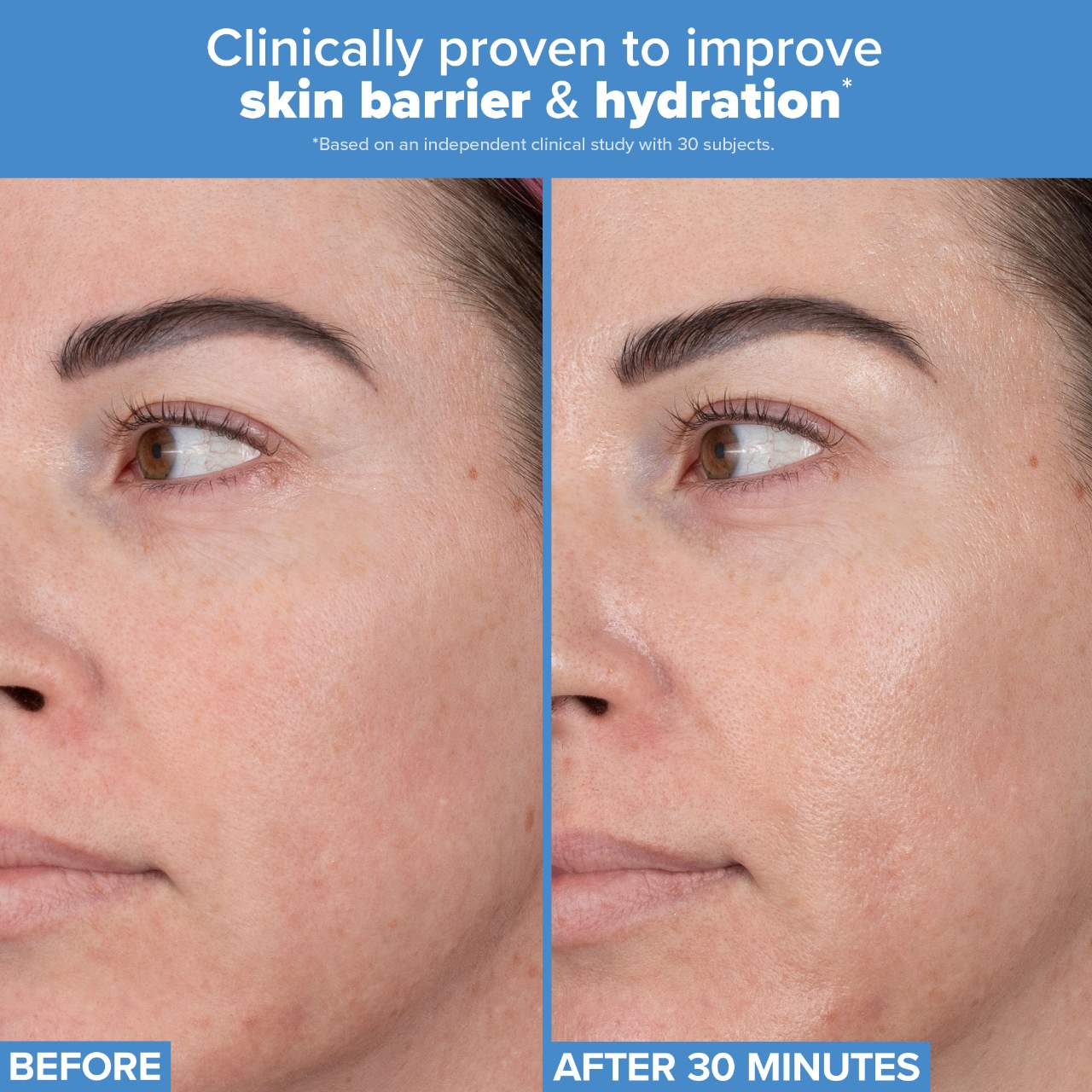 Paula's Choice - RESIST Barrier Repair Advanced Moisturizer with Ceramides | 50 mL - Medaid International